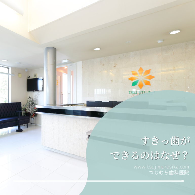 すきっ歯ができるのはなぜ?